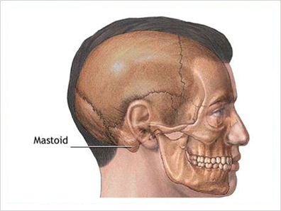 mastoid surgery in janakpuri